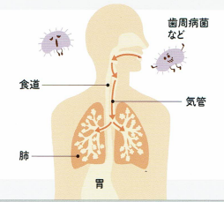 歯周病治療