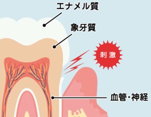 綾瀬(葛飾区)の歯医者、メリー歯科で神経を抜いた歯の寿命についての解説