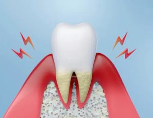 綾瀬（葛飾区）の歯医者、メリー歯科で歯並びが与える老後の影響を解説