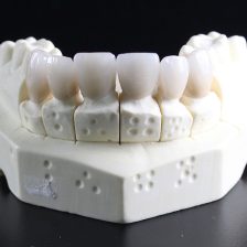 綾瀬（葛飾区）の歯医者、メリー歯科でセラミック矯正を後悔する理由とは？メリット・デメリットを解説