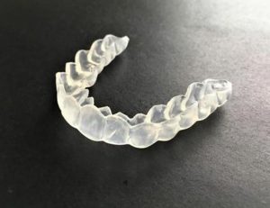 綾瀬（葛飾区）の歯医者、メリー歯科で歯ぎしり用マウスピースの正しい使い方とお手入れ方法を解説